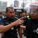 Perbuatan keji, mesti dikecam kerana serang polis – Anwar